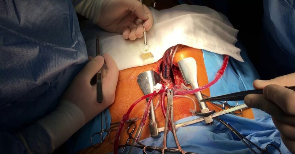 Cirurgia Maranhão